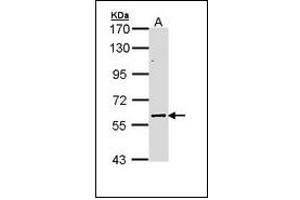 Sample (30 ug of whole cell lysate). (ELP3/KAT9 antibody)