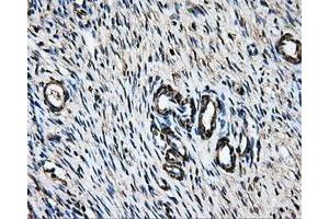Immunohistochemical staining of paraffin-embedded liver tissue using anti-LOXmouse monoclonal antibody. (LOX antibody  (AA 22-168))