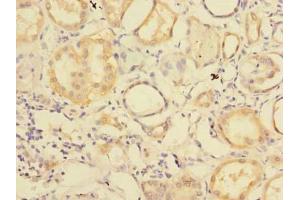 Immunohistochemistry of paraffin-embedded human kidney tissue using ABIN7151160 at dilution of 1:100 (RNF181 antibody  (AA 2-153))