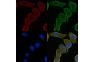 ABIN6259339 and ABIN6275439 staining Hela cells(30 min of UV treatment) by IF/ICC. (RSAD1 antibody  (Internal Region))