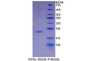SDS-PAGE (SDS) image for Bone Morphogenetic Protein 15 (BMP15) (AA 274-390) protein (His tag) (ABIN1879965)