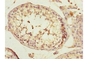 Immunohistochemistry of paraffin-embedded human testis tissue using ABIN7170585 at dilution of 1:100 (SPICE1 antibody  (AA 1-220))