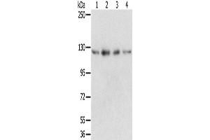 Western Blotting (WB) image for anti-RNA Binding Motif Protein 5 (RBM5) antibody (ABIN2424059) (RBM5 antibody)