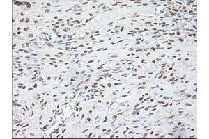 Immunohistochemistry (IHC) image for anti-POU Class 5 Homeobox 1 (POU5F1) antibody (ABIN1500354) (OCT4 antibody)
