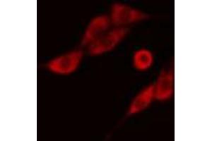 ABIN6274279 staining COLO205 cells by IF/ICC. (NCBP2 antibody  (N-Term))