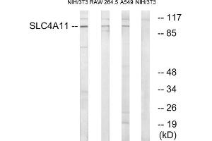 Western blot analysis of extracts from 3T3 cells, RAW264. (SLC4A11 antibody  (Internal Region))