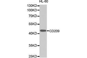 Western Blotting (WB) image for anti-CD209 (CD209) (AA 265-404) antibody (ABIN1679076) (DC-SIGN/CD209 antibody  (AA 265-404))