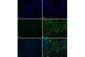 Primary rat hippocampal neurons show lewy body inclusion formation when treated with active Alpha Synuclein Protein Aggregate  at 4 µg/ml (D-F), but not when treated with control Alpha Synuclein Protein Aggregate  at 4 µg/ml (A-C). (SNCA Protein (full length))