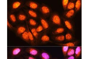 Immunofluorescence analysis of U2OS cells using YWHAE Polyclonal Antibody at dilution of 1:100. (YWHAE antibody)