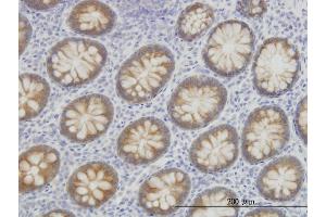 Immunoperoxidase of monoclonal antibody to ACSL5 on formalin-fixed paraffin-embedded human colon. (ACSL5 antibody  (AA 91-186))