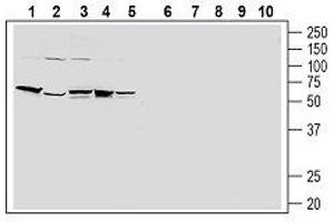Western blot analysis of human HT-29 colon adenocarcinoma cell line lysate (lanes 1 and 6), human PANC-1 pancreatic carcinoma cell line lysate (lanes 2 and 7), human THP-1 monocytic leukemia cell line lysate (lanes 3 and 8), human Jurkat T-cell leukemia cell line lysate (lanes 4 and 9) and human MCF-7 breast adenocarcinoma cell line lysate (lanes 5 and 10): - 1-5. (F2RL1 antibody  (Extracellular, N-Term))