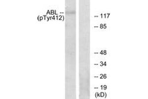 Western Blotting (WB) image for anti-C-Abl Oncogene 1, Non-Receptor tyrosine Kinase (ABL1) (pTyr393) antibody (ABIN2888351) (ABL1 antibody  (pTyr393))