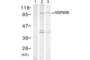 Western blot analysis of extract from HeLa cells, untreated or treated with UV or Heat shock, using HSP90B (Ab-254) antibody (E021290). (HSP90AB1 antibody)