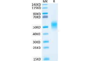 IL7R Protein (His tag)