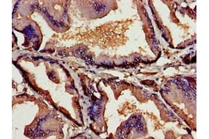 Immunohistochemistry of paraffin-embedded human prostate tissue using ABIN7172109 at dilution of 1:100 (Thymic Stromal Lymphopoietin antibody  (AA 29-159))