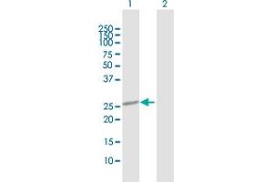 Western Blot analysis of OTUB2 expression in transfected 293T cell line by OTUB2 MaxPab polyclonal antibody. (OTUB2 antibody  (AA 1-234))