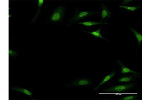 Immunofluorescence of monoclonal antibody to PLEC1 on HeLa cell. (PLEC antibody  (AA 4384-4493))