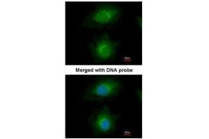 ICC/IF Image Immunofluorescence analysis of paraformaldehyde-fixed HeLa, using MVD, antibody at 1:200 dilution. (MVD antibody  (Center))