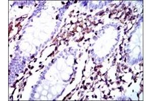 Immunohistochemistry (IHC) image for anti-Moesin (MSN) antibody (ABIN1108275) (Moesin antibody)