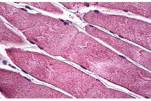 Human Skeletal Muscle: Formalin-Fixed, Paraffin-Embedded (FFPE) (PIM1 antibody  (AA 1-314))