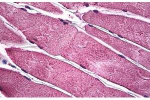 Human Skeletal Muscle: Formalin-Fixed, Paraffin-Embedded (FFPE) (PIM1 antibody  (AA 1-314))