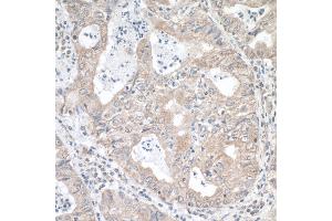 Immunohistochemistry (IHC) image for anti-Methylenetetrahydrofolate Reductase (NAD(P)H) (MTHFR) (AA 1-50) antibody (ABIN7453518)