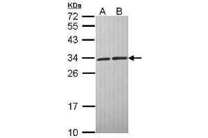 WB Image Sample (30 ug of whole cell lysate) A: A431 , B: H1299 12% SDS PAGE antibody diluted at 1:1000 (CACYBP antibody  (C-Term))