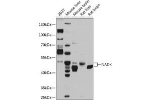 Western blot analysis of extracts of various cell lines, using NADK antibody (ABIN6128326, ABIN6144340, ABIN6144341 and ABIN6224894) at 1:1000 dilution.