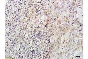 Formalin-fixed and paraffin embedded mouse tumor labeled with Anti-? (POMC antibody  (AA 237-267))