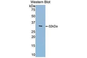 Western Blotting (WB) image for anti-Meningioma Expressed Antigen 5 (Hyaluronidase) (MGEA5) (AA 319-450) antibody (ABIN1859957) (MGEA5 antibody  (AA 319-450))
