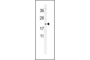 DMRTC1 Antibody (N-term) (ABIN654523 and ABIN2844245) western blot analysis in MDA-M cell line lysates (35 μg/lane). (DMRTC1 antibody  (N-Term))