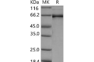 Western Blotting (WB) image for EPH Receptor B2 (EPHB2) (AA 570-987) (Active) protein (GST tag,His tag) (ABIN7317086) (EPH Receptor B2 Protein (EPHB2) (AA 570-987) (GST tag,His tag))
