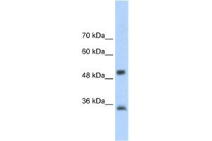 WB Suggested Anti-AIP Antibody Titration:  2. (AIP antibody  (N-Term))