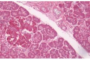 Human Pancreas: Formalin-Fixed, Paraffin-Embedded (FFPE) (LPAR6 antibody  (C-Term))