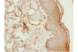 Immunohistochemistry of paraffin-embedded human skin tissue using ABIN7158391 at dilution of 1:100 (LHX6 antibody  (AA 114-363))