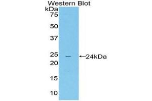 Detection of Recombinant LILRB4, Mouse using Polyclonal Antibody to Leukocyte Immunoglobulin Like Receptor Subfamily B, Member 4 (LILRB4) (LILRB4 antibody  (AA 24-206))