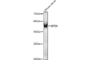 SETD6 antibody  (AA 301-473)