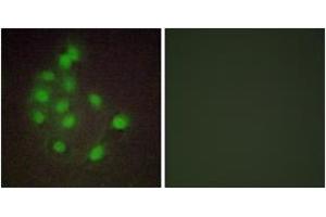 Immunofluorescence analysis of A549 cells, using HAND1 Antibody. (HAND1 antibody  (AA 141-190))