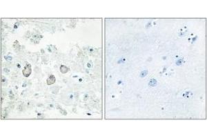 Immunohistochemistry (IHC) image for anti-Docking Protein 7 (DOK7) (AA 10-59) antibody (ABIN6766020) (DOK7 antibody  (AA 10-59))