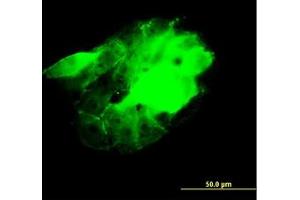 Image no. 4 for anti-CDC42 Binding Protein Kinase beta (DMPK-Like) (CDC42BPB) (AA 1580-1679) antibody (ABIN599085) (CDC42BPB antibody  (AA 1580-1679))