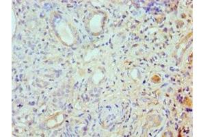 Immunohistochemistry of paraffin-embedded human kidney tissue using ABIN7168003 at dilution of 1:100 (ROCK2 antibody  (AA 1109-1388))