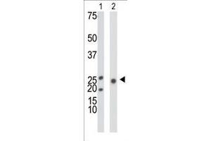 The anti-KHK Pab (ABIN391088 and ABIN2841229) is used in Western blot to detect KHK in mouse liver tissue lysate (Lane 1) and 293 cell lysate (Lane 2). (Ketohexokinase antibody  (N-Term))