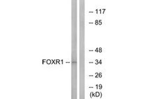 Western Blotting (WB) image for anti-Forkhead Box R1 (FOXR1) (AA 231-280) antibody (ABIN2890325) (FOXR1 antibody  (AA 231-280))