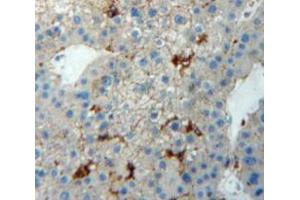 Used in DAB staining on fromalin fixed paraffin-embedded Liver tissue (TJP1 antibody  (AA 1-190))