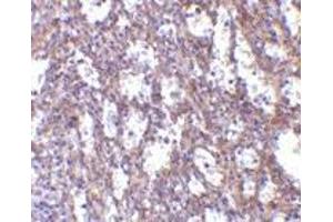 Immunohistochemistry of IL-32 in human spleen tissue with IL-32 antibody at 10 μg/ml. (IL32 antibody  (C-Term))