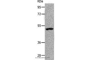 Western blot analysis of Human lymphoma tissue, using NDRG1 Polyclonal Antibody at dilution of 1:1000