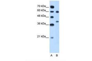 Image no. 2 for anti-Arginase, Liver (ARG1) (AA 101-150) antibody (ABIN320968)