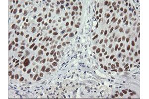 Image no. 8 for anti-SEC14 and Spectrin Domains 1 (SESTD1) antibody (ABIN1501066) (SESTD1 antibody)