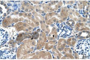 Human kidney (SDCBP antibody  (Middle Region))