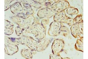 Immunohistochemistry of paraffin-embedded human placenta tissue using ABIN7163449 at dilution of 1:100 (PIH1D1 antibody  (AA 1-290))